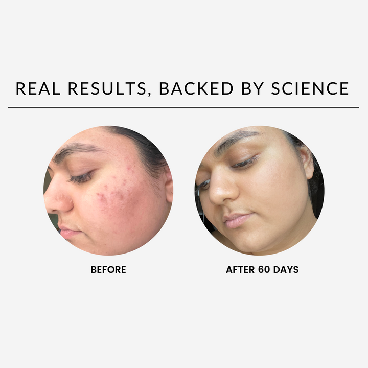 Before-and-after of skin using the brightening day-and-night set.
