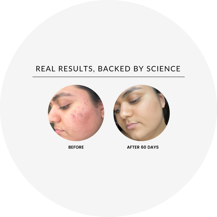 Before-and-after of skin using the vitamin C brightening serum, showing brighter-looking skin.